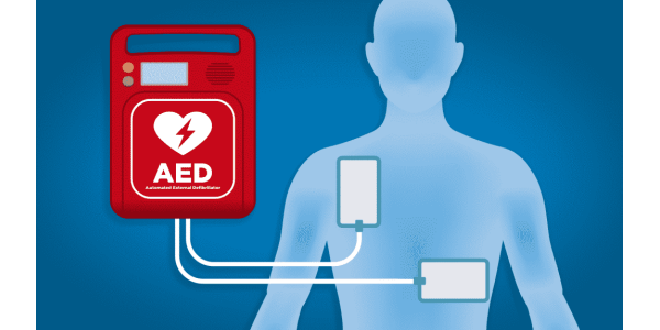 Automated External Defibrillators