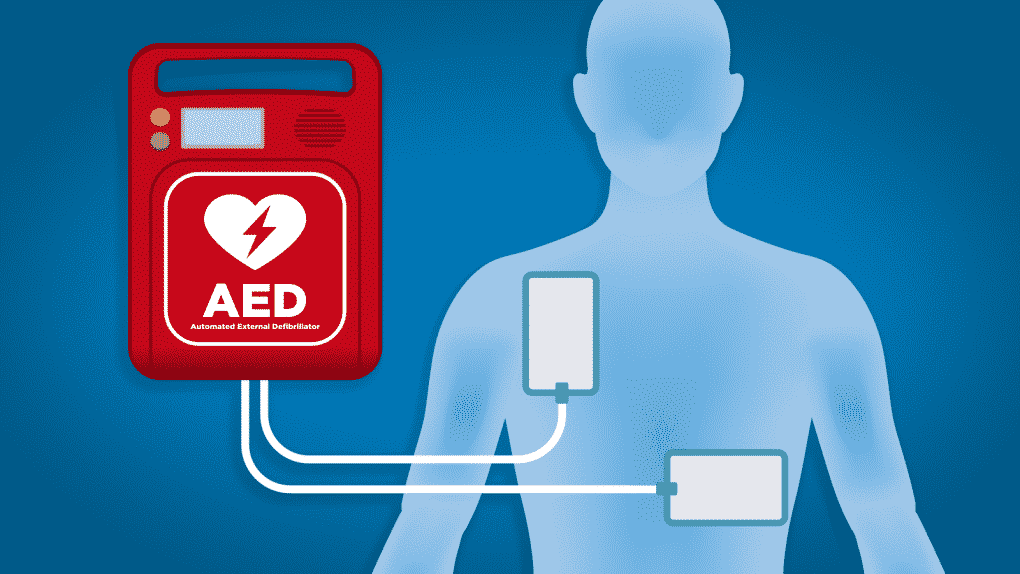 Automated External Defibrillators