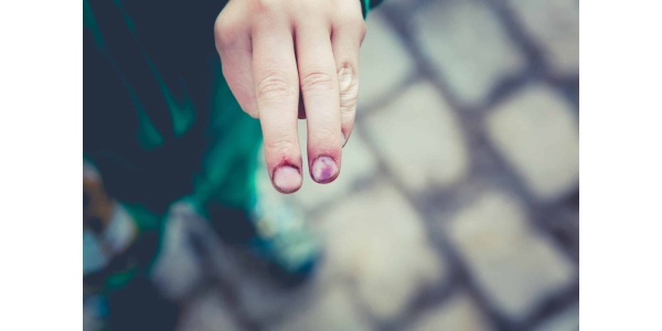 Identifying Child Abuse